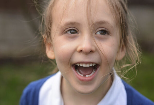 ¿Es normal que un niño de 6 años no haya perdido ningún diente?